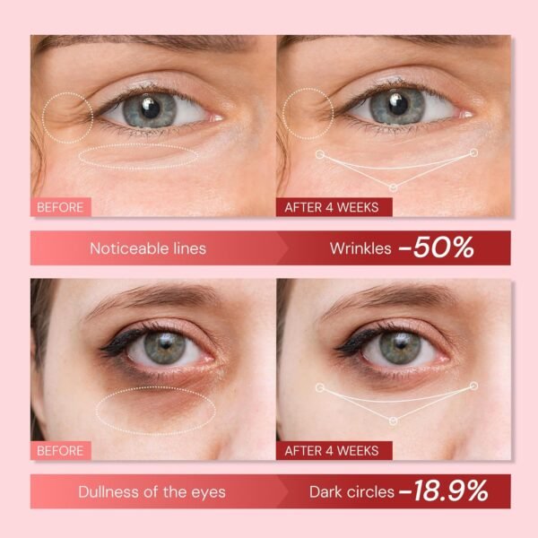 Retinol & Polypeptides Anti-Aging Eye Cream: Under Eye Treatment Reduces Wrinkles, Fine Lines, Dark Circles, Crow’s Feet & Puffiness – 0.85 Fl Oz - Image 3