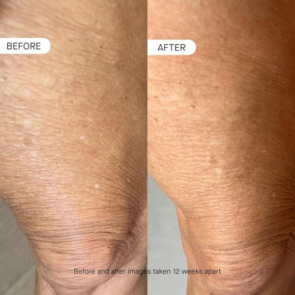 BODY OS-01 Peptide Skin Longevity Daily Moisturizer- Improves Skin Texture & Barrier, Safe for Sensitive Skin - Image 5