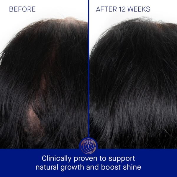 Augustinus Bader The Scalp Treatment - Image 4