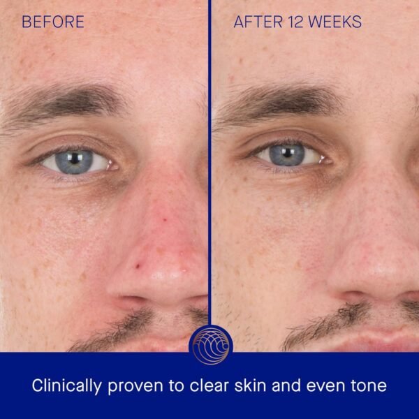 The Retinol Serum - Image 4