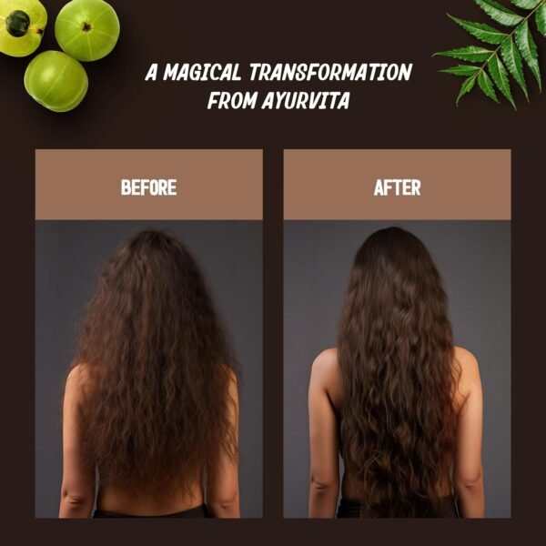 Restorative Hair Oil - Amla for Strengthening & Neem for Preventing Dryness and Dandruff - For Dry, Damaged Hair Growth - For Men & Women - 2 fl oz - Image 5