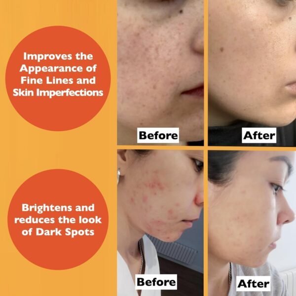 Vitamin C Serum For Face – Anti-Aging Facial Serum with Vitamin C, Hyaluronic Acid, Niacinamide, B5 & Vit E. Brightening Facial Essence for Dark Spots, Fine Lines, Wrinkles & Glowing Skin, 2 Fl Oz - Image 6