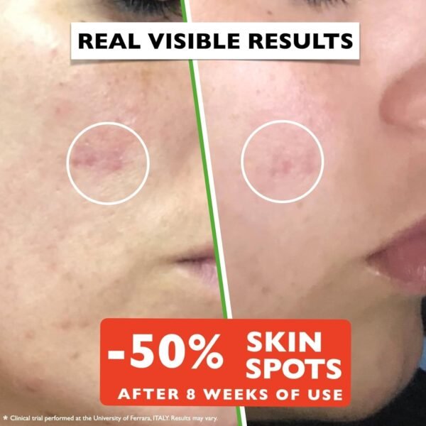 Vitamin C Serum For Face – Anti-Aging Facial Serum with Vitamin C, Hyaluronic Acid, Niacinamide, B5 & Vit E. Brightening Facial Essence for Dark Spots, Fine Lines, Wrinkles & Glowing Skin, 2 Fl Oz - Image 5